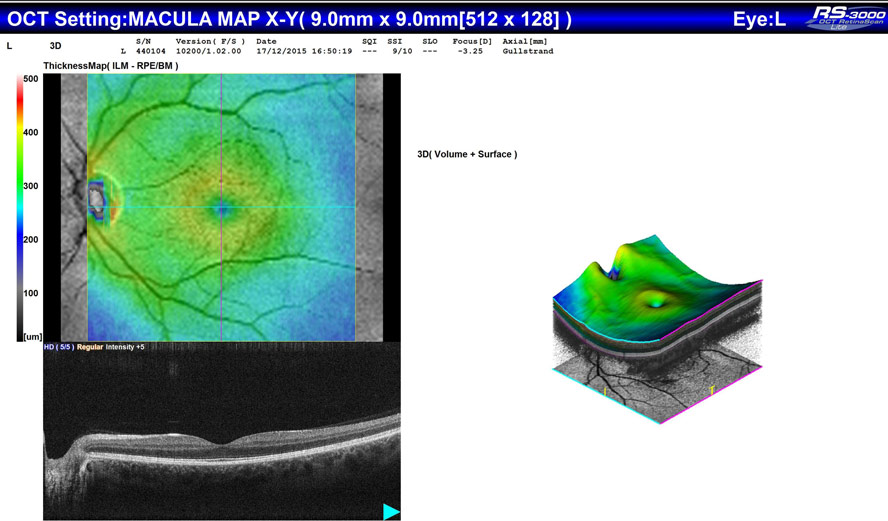 Macula and Retinal Scanning